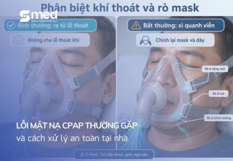 Lỗi mặt nạ CPAP thường gặp và cách xử lý an toàn tại nhà