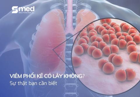 Viêm phổi kẽ có lây không? Sự thật bạn cần biết ngay